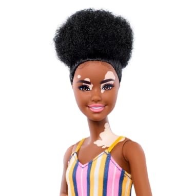  Mattel Introduces Barbie Doll With Vitiligo