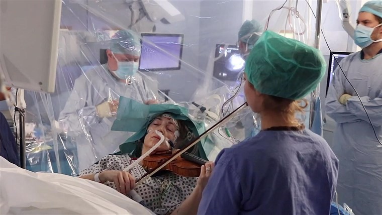  Brain Surgery Patient Plays Violin During Operation