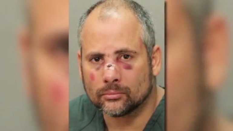  Jacksonville Man Suffers A Broken Nose and Two Black Eyes During Arrest