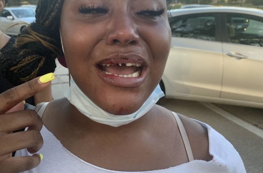  Police Officer Knocks Out 18-Year-Old Black Woman’s Teeth at Chicago Protest