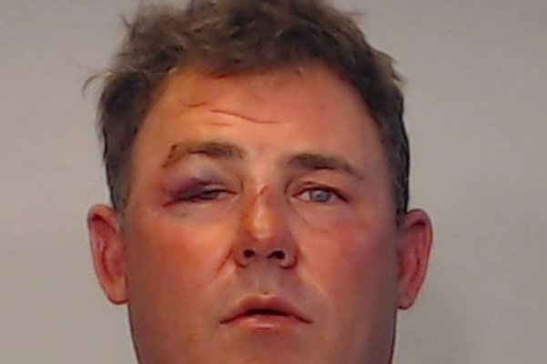  Florida Man Partially Bites Friend’s Ear Off In Scuffle Involving Drunk Woman & A Wheelbarrow
