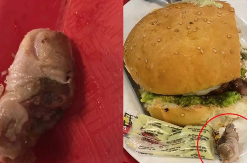  Woman Outraged After Discovering Rotting Human Finger In Burger At Fast-Food Restaurant
