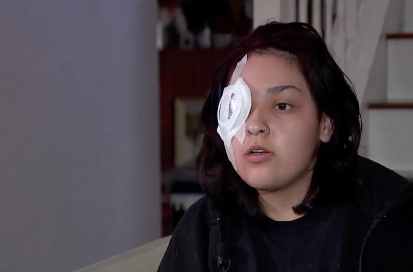  19-Year-Old Fast Food Worker Loses An Eye While Defending Special Needs Boy From Bullies
