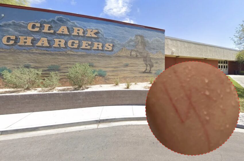  Autistic Jewish Teen Attacked And Has Swastika Carved Into Back At Las Vegas High School